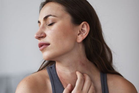 Rode vlekken op huid door stress: Hoe kom je ervan af? - BrellaVio